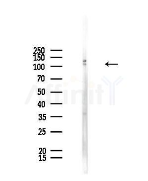 SLC4A9 Antibody - Western blot analysis of lysates from Mouse testis, using SLC4A9 Antibody at 1/1000 dilution.
