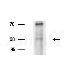 APOL5 Antibody - Western blot analysis of extracts from HepG2 cells(LPS, 4h treatment), using APOL5 Antibody at 1/1000 dilution.