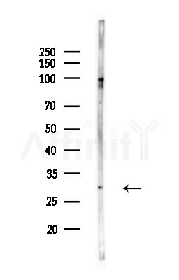 AQP10 Antibody - Western blot analysis of lysates from PC12 cells(UV,30min treatment), using AQP10 Antibody at 1/1000 dilution.