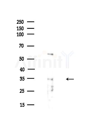 AQP8 Antibody - Western blot analysis of lysates from A375 cells(heat-shock,45min treatment), using AQP8 Antibody at 1/1000 dilution.
