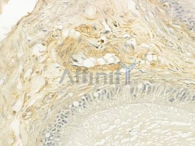 AQP8 Antibody - DF9224 at 1/100 staining human testicular cancer by IHC-P.