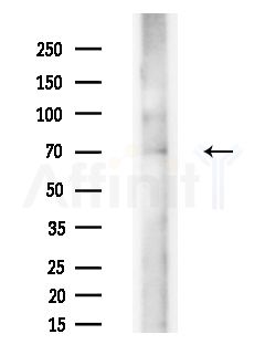 ATE1 Antibody - Western blot analysis of extracts from HepG2 cells(LPS, 4h treatment), using ATE1 Antibody at 1/1000 dilution.