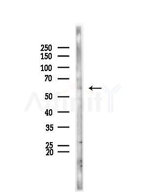 ATE1 Antibody - Western blot analysis of lysates from HepG2 cells(LPS, 4h treatment), using ATE1 Antibody at 1/1000 dilution.