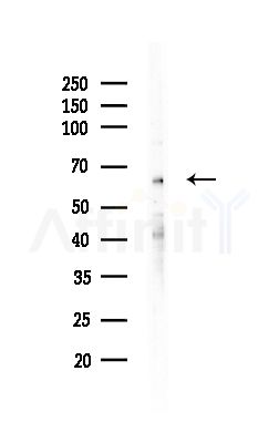 ARSJ Antibody - Western blot analysis of lysates from MCF7 cells(heat-shock,45min treatment), using ARSJ Antibody at 1/1000 dilution.