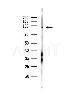 ATXN7 Antibody - Western blot analysis of lysates from PC12 cells(heat-shock,45min treatment), using ATXN7 Antibody at 1/1000 dilution.