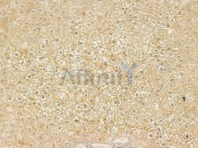 ATXN7 Antibody - DF9233 at 1/100 staining human normal liver tissue by IHC-P.