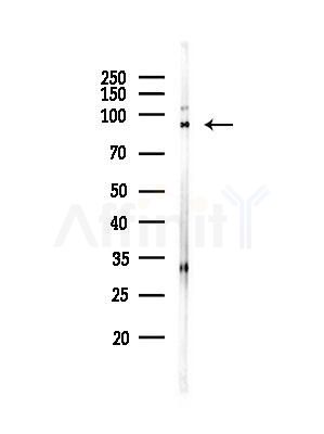 ATXN7L1 Antibody - Western blot analysis of lysates from PC12 cells(heat-shock,45min treatment), using ATXN7L1 Antibody at 1/1000 dilution.