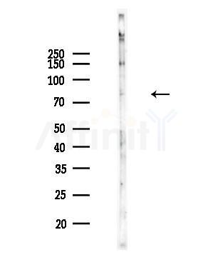 ABCB8 Antibody - Western blot analysis of lysates from Rat brain, using ABCB8 Antibody at 1/1000 dilution.