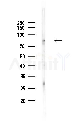 ABCF3 Antibody - Western blot analysis of lysates from PC12 cells(UV,30min treatment), using ABCF3 Antibody at 1/1000 dilution.