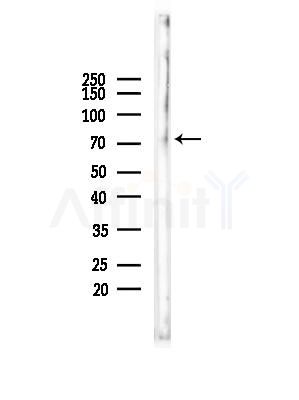 ABCG4 Antibody - Western blot analysis of lysates from HepG2 cells(starvation,24h treatment), using ABCG4 Antibody at 1/1000 dilution.