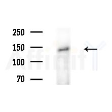 RECQL4 Antibody - Western blot analysis of extracts from Rat brain, using RECQL4 Antibody at 1/1000 dilution.
