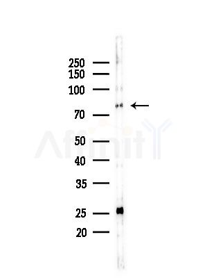 DDX18 Antibody - Western blot analysis of lysates from LoVo cells(heat-shock,45min treatment), using DDX18 Antibody at 1/1000 dilution.
