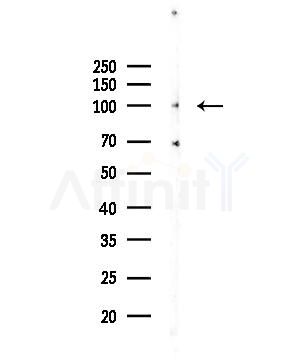 DDX42 Antibody - Western blot analysis of lysates from PC12 cells(LPS 4h treatment), using DDX42 Antibody at 1/1000 dilution.