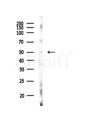 KCNJ14 Antibody - Western blot analysis of lysates from HUVEC cells(heat-shock, 45min treatment), using KCNJ14 Antibody at 1/1000 dilution.