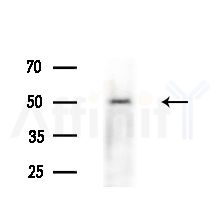 KCNJ15 Antibody - Western blot analysis of lysates from various samples, using KCNJ15 Antibody at 1/1000 dilution.