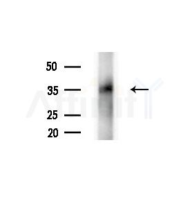B3GALT5 Antibody - Western blot analysis of lysates from HepG2 cells(LPS, 4h treatment), using B3GALT5 Antibody at 1/1000 dilution.