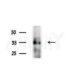 B3GALT5 Antibody - Western blot analysis of lysates from PC12 cells(starvation,24h treatment), using B3GALT5 Antibody at 1/1000 dilution.