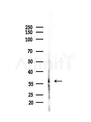 B3GALT5 Antibody - Western blot analysis of lysates from PC12 cells(starvation,24h treatment), using B3GALT5 Antibody at 1/1000 dilution.