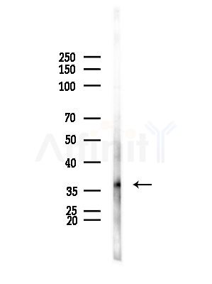 B3GALT5 Antibody - Western blot analysis of lysates from HepG2 cells(LPS, 4h treatment), using B3GALT5 Antibody at 1/1000 dilution.