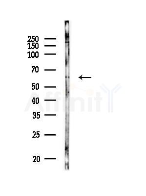 B4GALNT2 Antibody - Western blot analysis of lysates from HUVEC cells(heat-shock, 45min treatment), using B4GALNT2 Antibody at 1/1000 dilution.