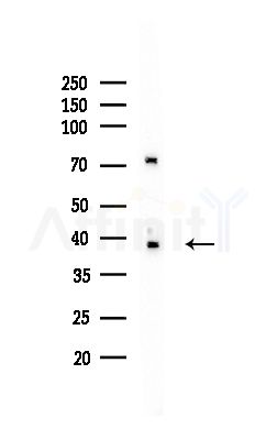 B4GALT4 Antibody - Western blot analysis of lysates from MCF7 cells(heat-shock,45min treatment), using B4GALT4 Antibody at 1/1000 dilution.