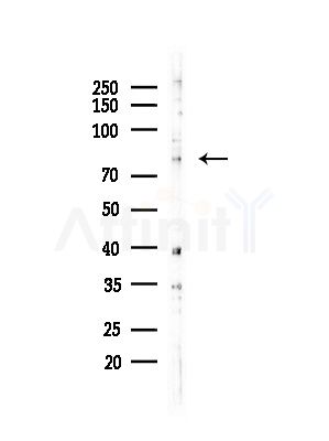 CEL Antibody - Western blot analysis of lysates from HepG2 cells(LPS,4h treatment), using CEL Antibody at 1/1000 dilution.
