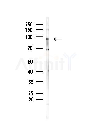 BMP1 Antibody - Western blot analysis of lysates from MDA-MB-231 cells(heat-shock,45min treatment), using BMP1 Antibody at 1/1000 dilution.