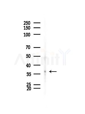 BCCIP Antibody - Western blot analysis of lysates from HepG2 cells(LPS, 4h treatment), using BCCIP Antibody at 1/1000 dilution.