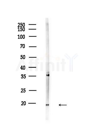 PPP3R1 Antibody - Western blot analysis of lysates from B16F10-LUC cells(UV,30min treatment), using PPP3R1 Antibody at 1/1000 dilution.