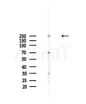 CABIN1 Antibody - Western blot analysis of lysates from A375 cells(starvation,24h treatment), using CABIN1 Antibody at 1/1000 dilution.