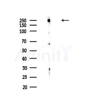 CABIN1 Antibody - Western blot analysis of lysates from HepG2 cells(LPS,4h treatment), using CABIN1 Antibody at 1/1000 dilution.