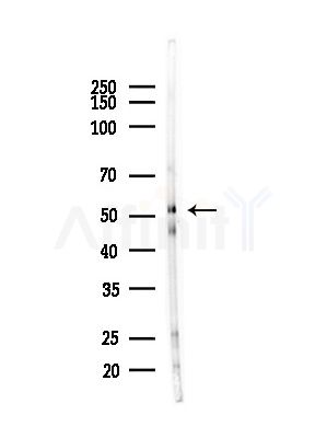 PDE1A Antibody - Western blot analysis of lysates from B16F10-LUC cells(starvation,24h treatment), using PDE1A Antibody at 1/1000 dilution.