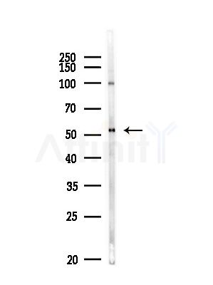 PDE1A Antibody - Western blot analysis of lysates from MDA-MB-231 cells(heat-shock,45min treatment), using PDE1A Antibody at 1/1000 dilution.