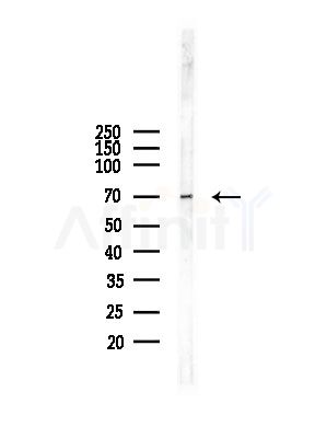 SLC25A13 Antibody - Western blot analysis of lysates from A375 cells(starvation,24h treatment), using SLC25A13 Antibody at 1/1000 dilution.