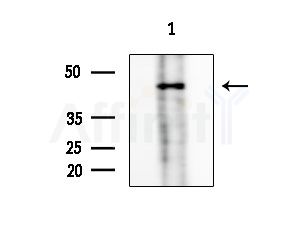 CABP1 Antibody - Western blot analysis of extracts from HepG2 cells(starvation treatment), using CABP1 Antibody at 1/1000 dilution.