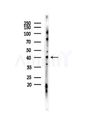 CABP1 Antibody - Western blot analysis of lysates from HepG2 cells(starvation,24h treatment), using CABP1 Antibody at 1/1000 dilution.