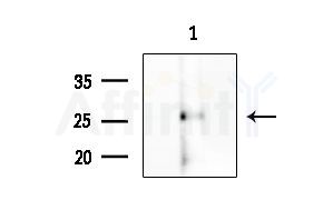 CABP2 Antibody - Western blot analysis of extracts from COLO205 cells, using CABP2 Antibody at 1/1000 dilution.