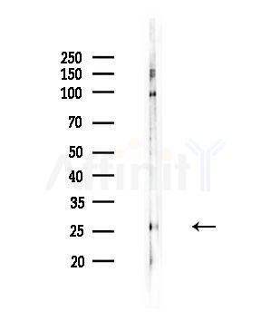 CABP2 Antibody - Western blot analysis of lysates from COLO205 cells, using CABP2 Antibody at 1/1000 dilution.