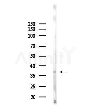 CAB39L Antibody - Western blot analysis of lysates from EC304 cells, using CAB39L Antibody at 1/1000 dilution.