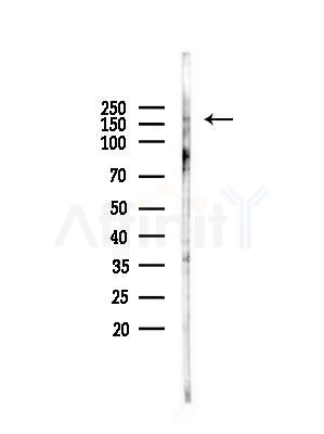 CAMTA1 Antibody - Western blot analysis of lysates from Hela cells(heat-shock,45min treatment), using CAMTA1 Antibody at 1/1000 dilution.
