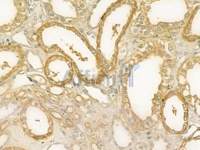 CALML5 Antibody - DF9316 at 1/100 staining human normal kidney tissue by IHC-P.