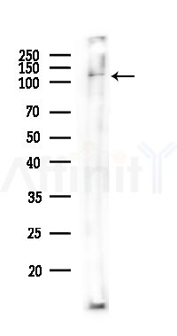 CAPN3 Antibody - Western blot analysis of lysates from Hela cells(heat-shock,45min treatment), using CAPN3 Antibody at 1/1000 dilution.