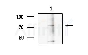 CAPN6 Antibody - Western blot analysis of extracts from Mouse testis, using CAPN6 Antibody at 1/1000 dilution.