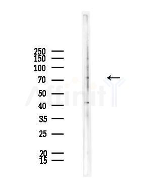 CAPN6 Antibody - Western blot analysis of lysates from Mouse testis, using CAPN6 Antibody at 1/1000 dilution.
