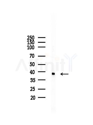 CNN3 Antibody - Western blot analysis of lysates from A375 cells(starvation,24h treatment), using CNN3 Antibody at 1/1000 dilution.
