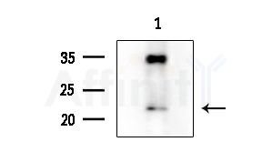 CTAG2 Antibody - Western blot analysis of extracts from COLO205 cells, using CTAG2 Antibody at 1/1000 dilution.