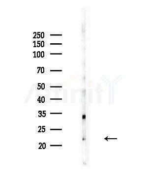 CTAG2 Antibody - Western blot analysis of lysates from COLO205 cells, using CTAG2 Antibody at 1/1000 dilution.