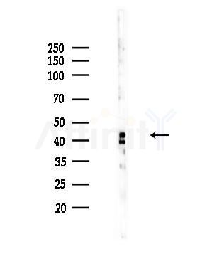 CHST11 Antibody - Western blot analysis of lysates from COLO205 cells, using CHST11 Antibody at 1/1000 dilution.
