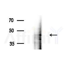 CHST12 Antibody - Western blot analysis of extracts from 3T3-L1 cells(heat-shock,45min treatment), using CHST12 Antibody at 1/1000 dilution.