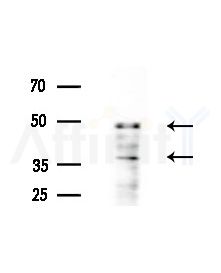 CHST14 Antibody - Western blot analysis of extracts from Mouse liver, using CHST14 Antibody at 1/1000 dilution.
